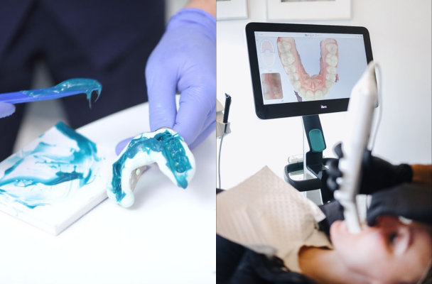 LẤY DẤU MẪU HÀM/SCAN ITERO
